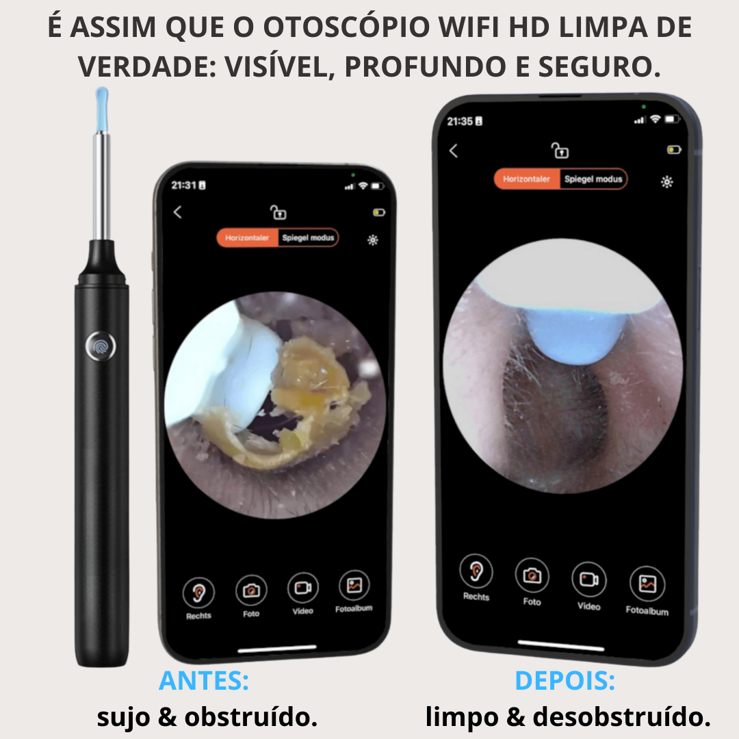 Otoscópio WiFi HD MILUNA-Pro