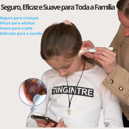 Otoscópio WiFi HD MILUNA-Pro