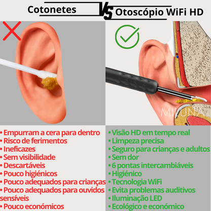 Otoscópio WiFi HD MILUNA-Pro