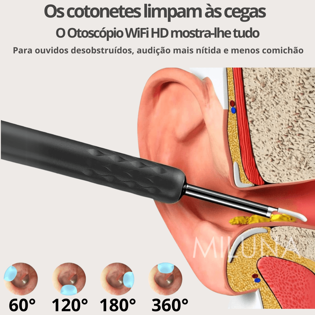 Otoscópio WiFi HD MILUNA-Pro