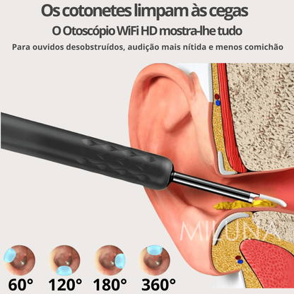 Otoscópio WiFi HD MILUNA-Pro